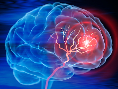 An illustration of a brain