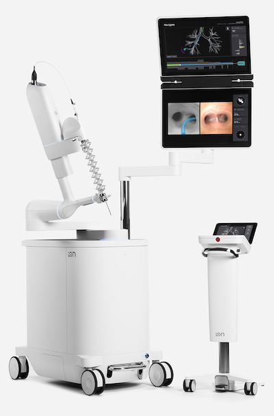 La plataforma de broncoscopia asistida por robot Ion