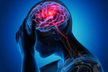 An illustration of a man holding his head